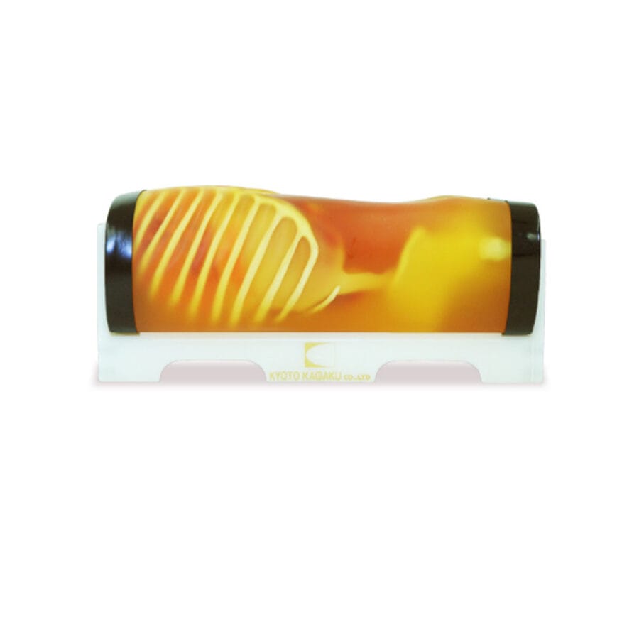 KYOTO KAGAKU FAST/Fantom za akutni abdomen "FAST/ER FAN"